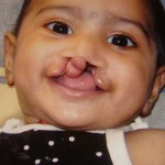 Smitha